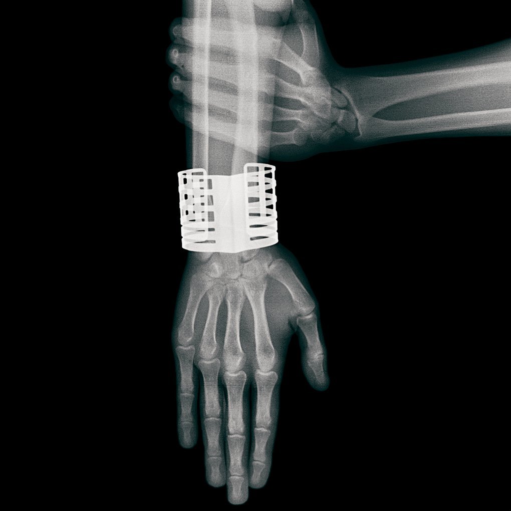 Подрамник xray артикул